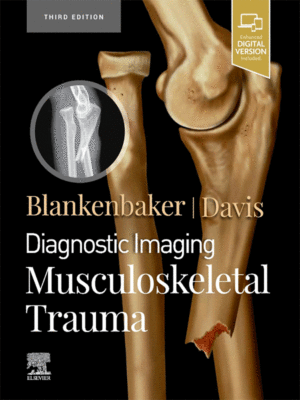 Diagnostic Imaging: Musculoskeletal Trauma, 3rd Edition