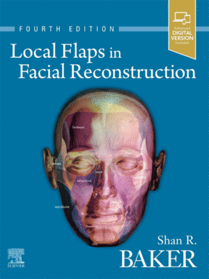 Local Flaps in Facial Reconstruction by Baker, 4th Edition