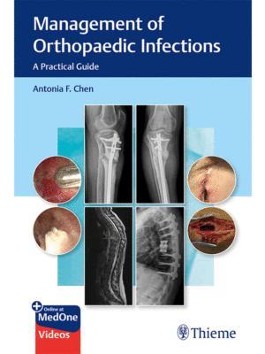 Management of Orthopaedic Infections: A Practical Guide