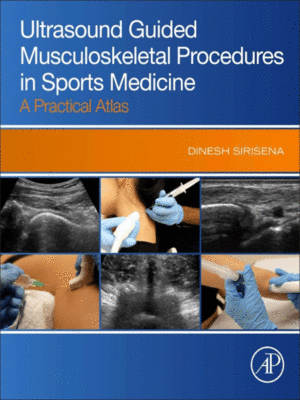 Ultrasound Guided Musculoskeletal Procedures in Sports Medicine: A Practical Atlas