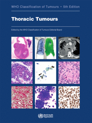 WHO Classification of Tumours: Thoracic Tumours, 5th Edition