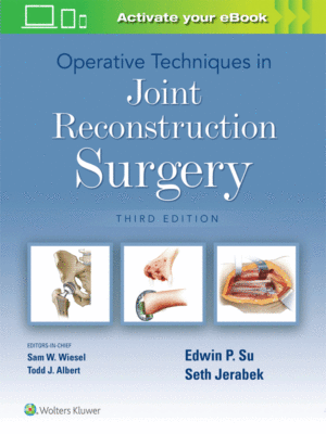 Operative Techniques in Joint Reconstruction Surgery, 3rd Edition