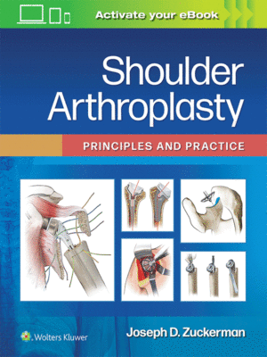 Shoulder Arthroplasty by Zuckerman: Principles and Practice