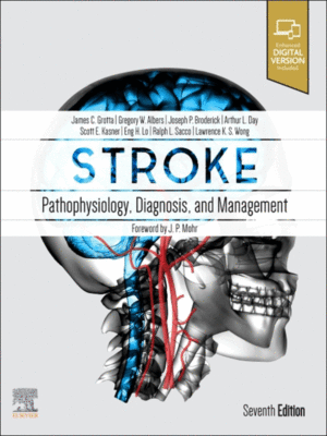 Stroke: Pathophysiology, Diagnosis, and Management, 7th Edition