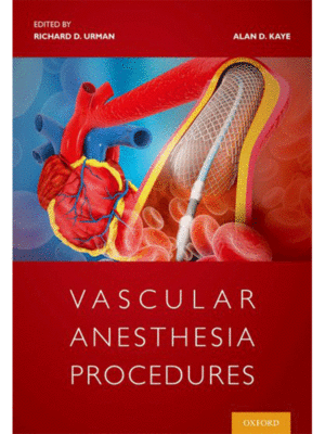 Vascular Anesthesia Procedures