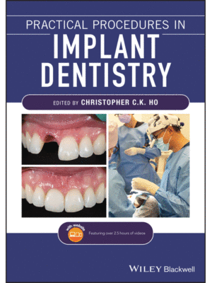 Practical Procedures in Implant Dentistry