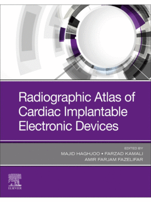 Radiographic Atlas of Cardiac Implantable Electronic Devices
