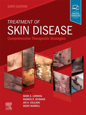 Treatment of Skin Disease by Lebwohl: Comprehensive Therapeutic Strategies, 6th Edition