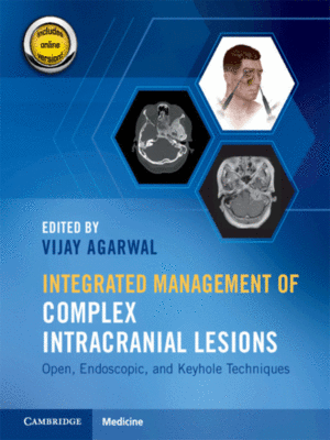 Integrated Management of Complex Intracranial Lesions: Open, Endoscopic, and Keyhole Techniques
