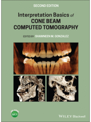 Interpretation Basics of Cone Beam Computed Tomography, 2nd Edition