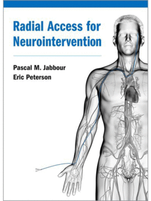 Radial Access for Neurointervention