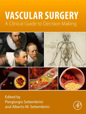 Vascular Surgery: A Clinical Guide to Decision-Making