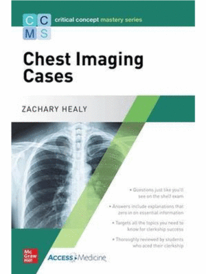 Critical Concept Mastery Series: Chest Imaging Cases