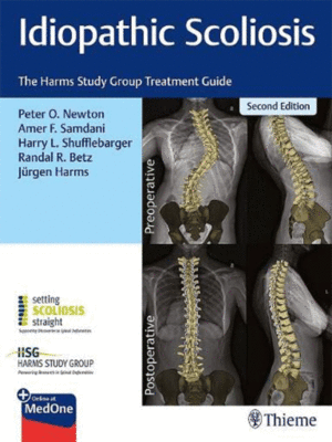 Idiopathic Scoliosis: The Harms Study Group Treatment Guide, 2nd Edition