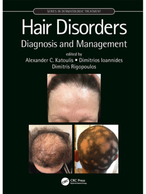 Hair Disorders: Diagnosis and Management
