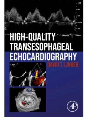 High-Quality Transesophageal Echocardiography