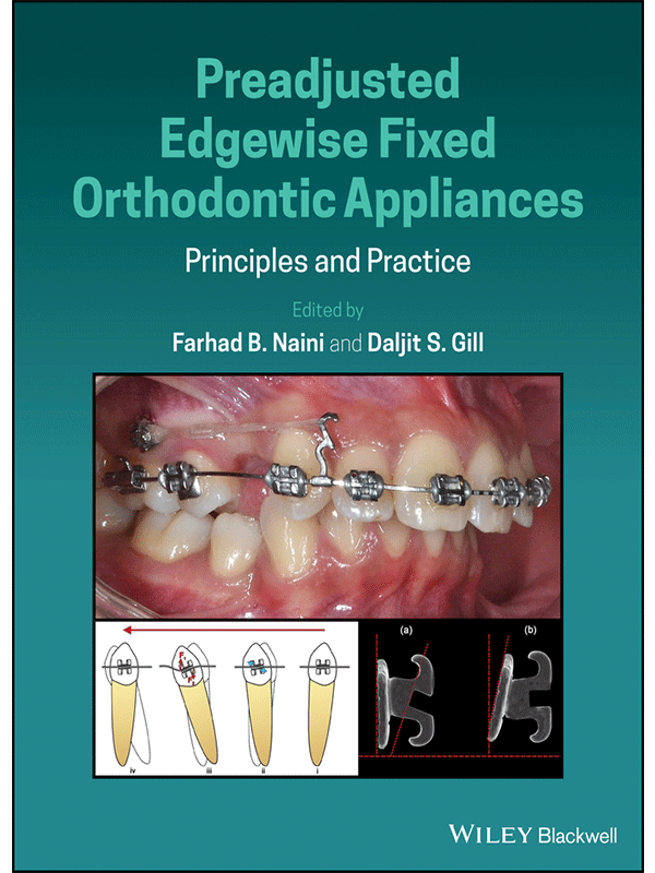 Preadjusted Edgewise Fixed Orthodontic Appliances: Principles and Practice