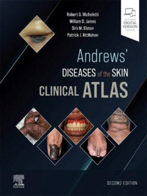 Andrews' Diseases of the Skin Clinical Atlas, 2nd Edition