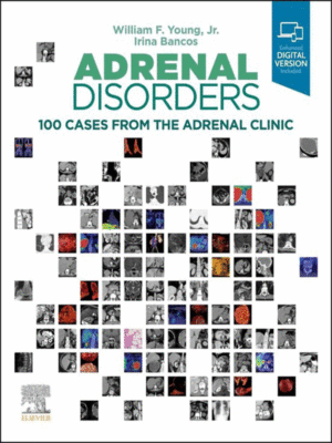 Adrenal Disorders (100 Cases from the Adrenal Clinic)