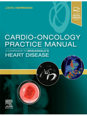Cardio-Oncology Practice Manual: A Companion to Braunwald’s Heart Disease
