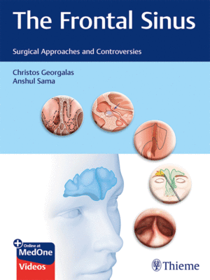 The Frontal Sinus: Surgical Approaches and Controversies