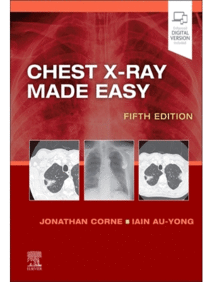Chest X-Ray Made Easy, 5th Edition