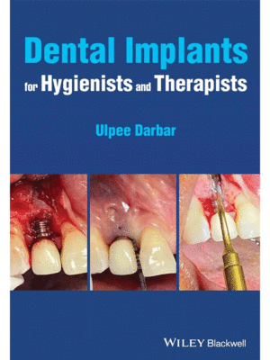 Dental Implants for Hygienists and Therapists