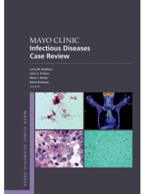 Mayo Clinic Infectious Diseases Case Review (With Board-Style Questions and Answers)