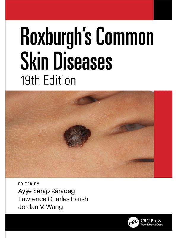 Roxburgh's Common Skin Diseases, 19th Edition Roxburgh's Common Skin Diseases, 19th Edition