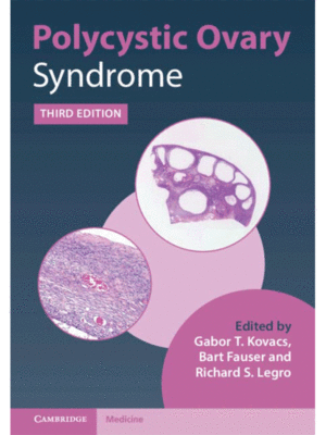 Polycystic Ovary Syndrome, 3rd Edition