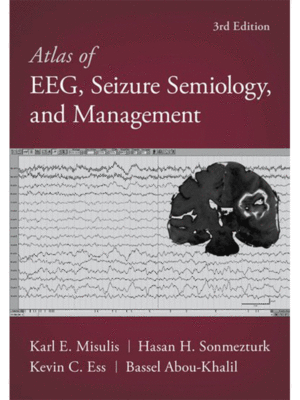 Atlas of EEG, Seizure Semiology, and Management, 3rd Edition