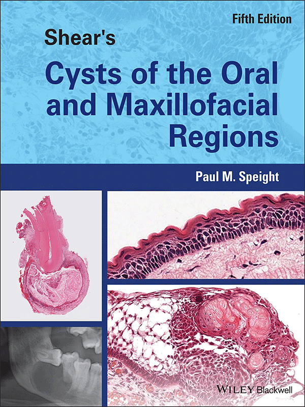 Shear's Cysts of the Oral and Maxillofacial Regions, 5th Edition