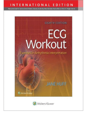 ECG Workout: Exercises in Arrythmia Interpretation, 8th Edition