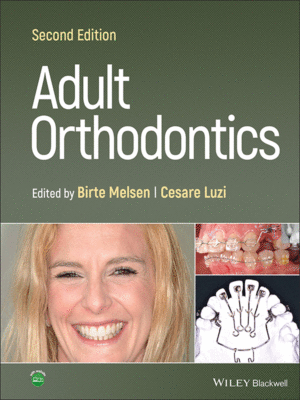 Adult Orthodontics, 2nd Edition
