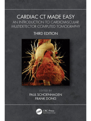 Cardiac CT Made Easy: An Introduction to Cardiovascular Multidetector Computed Tomography, 3rd Edition