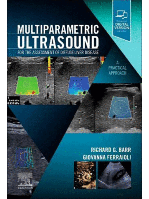 Multiparametric Ultrasound for the Assessment of Diffuse Liver Disease: A Practical Approach