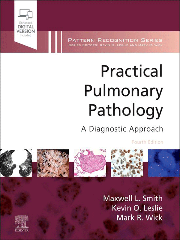 Practical Pulmonary Pathology: A Diagnostic Approach, 4th Edition