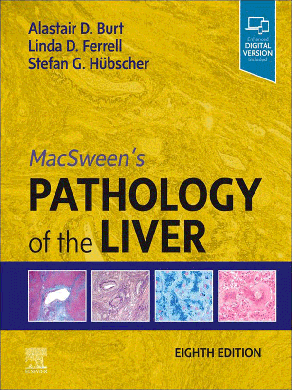 MacSween's Pathology of the Liver, 8th Edition