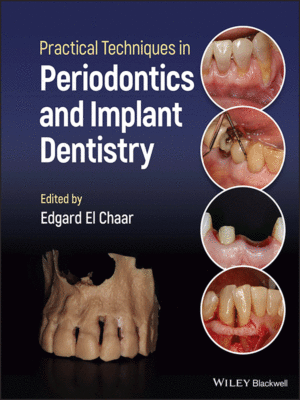 Practical Techniques in Periodontics and Implant Dentistry