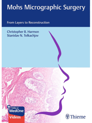 Mohs Micrographic Surgery: From Layers to Reconstruction