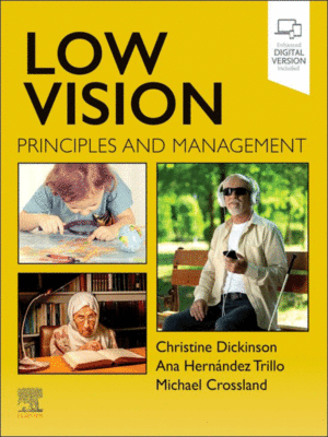 Low Vision: Principles and Management