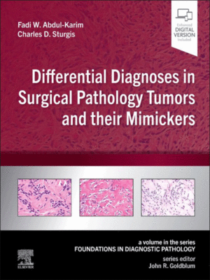 Differential Diagnoses in Surgical Pathology Tumors and their Mimickers (A Volume in the Foundations in Diagnostic Pathology Series)