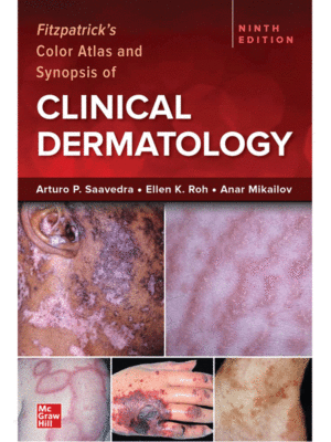 Fitzpatrick's Color Atlas and Synopsis of Clinical Dermatology, 9th Edition