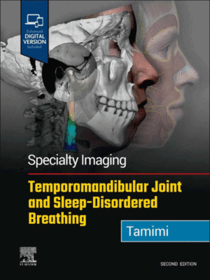 Specialty Imaging: Temporomandibular Joint and Sleep-Disordered Breathing, 2nd Edition