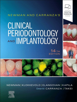 Newman and Carranza's Clinical Periodontology and Implantology, 14th Edition
