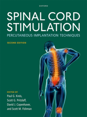 Spinal Cord Stimulation: Percutaneous Implantation Techniques, 2nd Edition