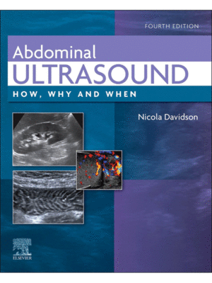 Abdominal Ultrasound: How, Why and When, 4th Edition