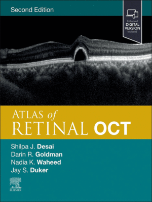 Atlas of Retinal OCT: Optical Coherence Tomography, 2nd Edition