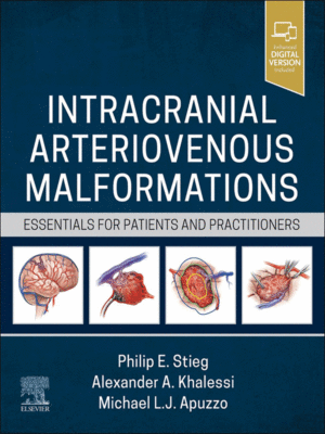 Intracranial Arteriovenous Malformations (Essentials for Patients and Practitioners)