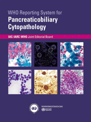 WHO Reporting System for Pancreaticobiliary Cytopathology IAC-IARC-WHO